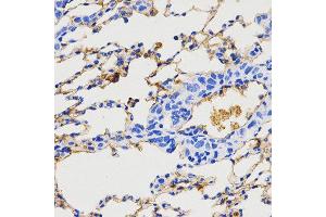 Immunohistochemistry (IHC) image for anti-Neuropeptide Y (NPY) (AA 1-97) antibody (ABIN3017529) (NPY antibody  (AA 1-97))