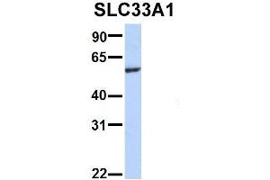 Host:  Rabbit  Target Name:  WT1  Sample Type:  721_B  Antibody Dilution:  1. (SLC33A1 antibody  (Middle Region))