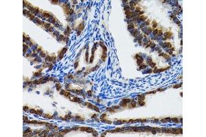 Immunohistochemistry of paraffin-embedded Rat fallopian tube using HSPH1 Polyclonal Antibody at dilution of 1:100 (40x lens). (HSPH1 antibody)