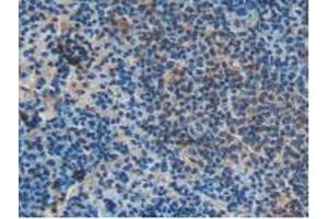 IHC-P analysis of Rat Spleen Tissue, with DAB staining. (Somatostatin antibody  (AA 27-116))
