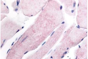 Human Skeletal Muscle (formalin-fixed, paraffin-embedded) stained with WNK1 antibody ABIN213554 at 4 ug/ml followed by biotinylated goat anti-rabbit IgG secondary antibody ABIN481713, alkaline phosphatase-streptavidin and chromogen. (WNK1 antibody  (Internal Region))