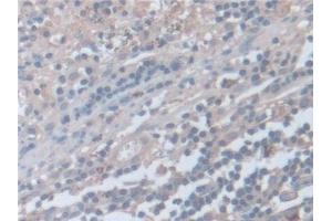 Immunohistochemistry (IHC) image for anti-Synaptosomal-Associated Protein, 23kDa (SNAP23) (AA 1-211) antibody (ABIN7444214)