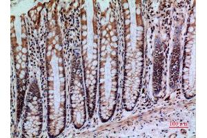 Immunohistochemistry (IHC) analysis of paraffin-embedded Human Colon, antibody was diluted at 1:100.