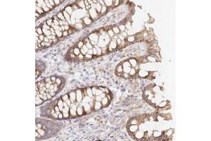 Immunohistochemical staining of human colon with TBC1D14 polyclonal antibody  shows moderate cytoplasmic positivity in glandular cells. (TBC1D14 antibody)