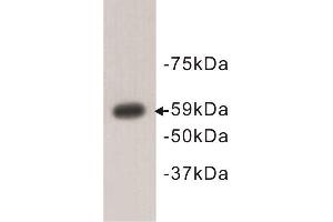 Western Blotting (WB) image for anti-Autoimmune Regulator (AIRE) antibody (ABIN1854830) (AIRE antibody)