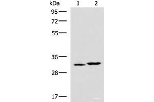 Western blot analysis of 293T cell lysates using CBR3 Polyclonal Antibody at dilution of 1:800 (CBR3 antibody)