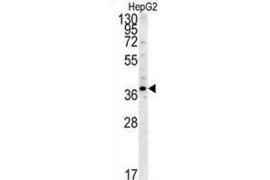 Western Blotting (WB) image for anti-Proteasome (Prosome, Macropain) 26S Subunit, Non-ATPase, 7 (PSMD7) antibody (ABIN3001711) (PSMD7 antibody)