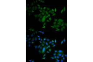 Immunofluorescence analysis of A549 cell using CASP9 antibody. (Caspase 9 antibody)
