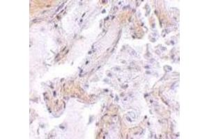 Immunohistochemistry of CAPN6 in human lung tissue with CAPN6 antibody at 2.