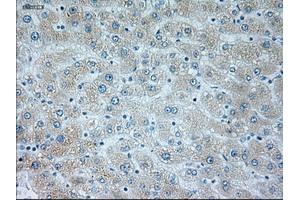 Immunohistochemical staining of paraffin-embedded liver tissue using anti-NEUROG1mouse monoclonal antibody. (Neurogenin 1 antibody)