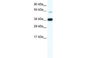 WB Suggested Anti-RELB Antibody Titration:  2. (RELB antibody  (Middle Region))