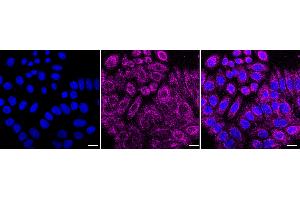 Immunocytochemical staining of HepG2 cells with Glucokinase antibody (ABIN7798729), 1:1,000). (Recombinant GCK antibody)