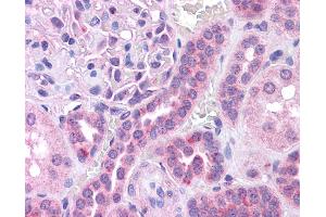 Immunohistochemistry (IHC) image for anti-V-Maf Musculoaponeurotic Fibrosarcoma Oncogene Homolog (Avian) (MAF) (N-Term) antibody (ABIN2780675) (MAF antibody  (N-Term))