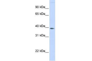 WB Suggested Anti-FAM76B Antibody Titration: 0. (FAM76B antibody  (Middle Region))