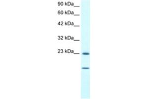 Western Blotting (WB) image for anti-Heat Shock 27kDa Protein 1 (HSPB1) antibody (ABIN2463726) (HSP27 antibody)