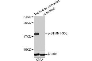 Western blot analysis of extracts of K-562 cells, using Phospho-STMN1-S38 antibody (ABIN2987644). (Stathmin 1 antibody  (pSer38))