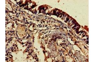 Immunohistochemistry of paraffin-embedded human lung tissue using ABIN7151760 at dilution of 1:100 (EDNRB antibody  (AA 27-101))