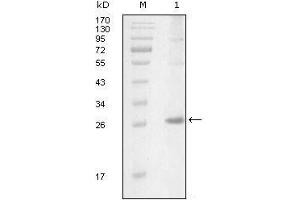 Western Blot showing ITK antibody used against truncated Trx-ITK recombinant protein (1).