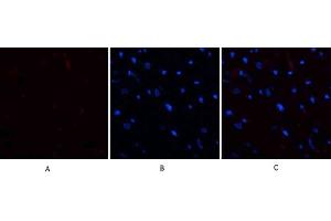 Immunofluorescence analysis of rat heart tissue. (E2F1 antibody  (AA 100-170))
