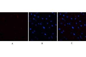 Immunofluorescence analysis of rat heart tissue. (E2F1 antibody  (AA 100-170))