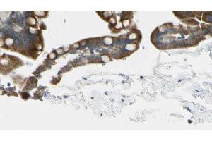 ABIN6268853 at 1/100 staining Mouse intestine tissue by IHC-P. (CRHR2 antibody  (Internal Region))