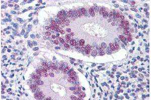 Human Uterus: Formalin-Fixed, Paraffin-Embedded (FFPE) (STK17A antibody  (AA 301-414))