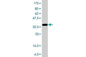 Western Blot detection against Immunogen (37. (BCOR antibody  (AA 1361-1460))