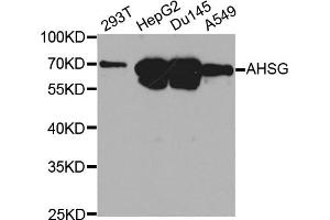 Western blot analysis of extracts of various cell lines, using AHSG antibody. (Fetuin A antibody)