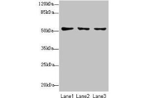 Western blot All lanes: SLC46A2 antibody at 8 μg/mL Lane 1: HT29 whole cell lysate Lane 2: Mouse liver tissue Lane 3: Mouse kidney tissue Secondary Goat polyclonal to rabbit IgG at 1/10000 dilution Predicted band size: 52 kDa Observed band size: 52 kDa