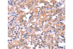 Immunohistochemistry (IHC) image for anti-FAT Tumor Suppressor Homolog 1 (FAT1) antibody (ABIN2434638)