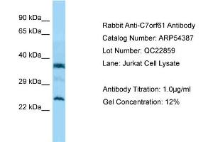 Western Blotting (WB) image for anti-Chromosome 7 Open Reading Frame 61 (C7orf61) (C-Term) antibody (ABIN2785686) (C7orf61 antibody  (C-Term))