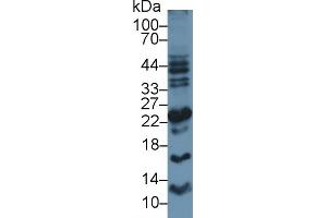 Detection of APOM in Human Placenta lysate using Polyclonal Antibody to Apolipoprotein M (APOM) (Apolipoprotein M antibody  (AA 8-188))
