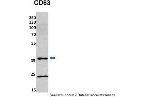 Sample Type: mouse fibroblast lusate (20ug)Primary Dilution: 1:800 (2% milk)Secondary Dilution: 1:2000 (5% milk)Image Submitted By: Anonymous researcher . (CD63 antibody  (C-Term))