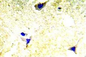 Immunohistochemistry (IHC) analyzes of PAK1/2 antibody in paraffin-embedded human brain tissue. (PAK1 antibody)