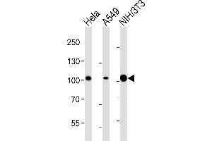 Western blot analysis of lysates from Hela, A549, mouse NIH/3T3 cell line (from left to right), using FER Antibody (ABIN6243360 and ABIN6577092).