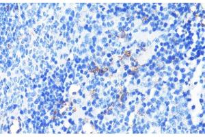 Immunohistochemistry of paraffin-embedded Mouse spleen using CD11A Polyclonal Antibody at dilution of 1:100 (40x lens). (ITGAL antibody)
