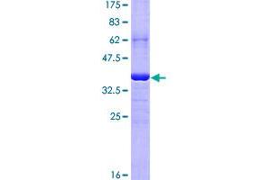 Image no. 1 for CD5 Molecule-Like (CD5L) (AA 41-140) protein (GST tag) (ABIN1348680) (CD5L Protein (AA 41-140) (GST tag))
