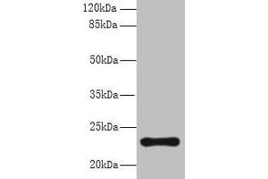 Western blot All lanes: AP3S2 antibody at 6 μg/mL + A549 whole cell lysate Secondary Goat polyclonal to rabbit IgG at 1/10000 dilution Predicted band size: 23, 44, 15 kDa Observed band size: 23 kDa (AP3S2 antibody  (AA 1-193))