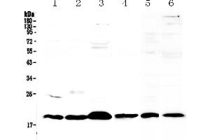 Western blot analysis of ICOS using anti-ICOS antibody . (ICOS antibody  (AA 21-200))