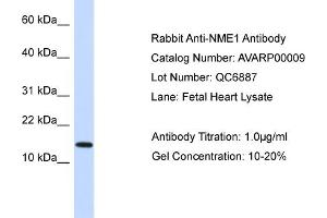 NME1 antibody - N-terminal region (AV) validated by WB using Fetal Heart Lysate at 1ug/ml.