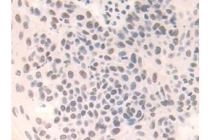 Immunohistochemistry (IHC) image for anti-Family with Sequence Similarity 19 (Chemokine (C-C Motif)-Like), Member A3 (FAM19A3) (AA 44-130) antibody (ABIN7441964)