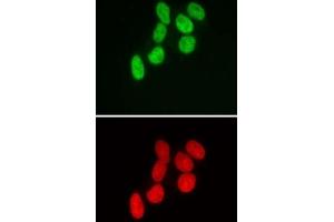 SMARCB1 antibody (mAb) (Clone 2C2) tested by immunofluorescence. (SMARCB1 antibody)