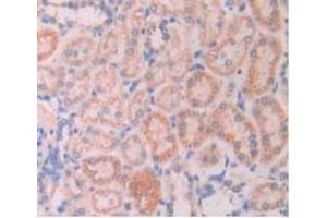 IHC-P analysis of Rat Kidney Tissue, with DAB staining. (LAMP2 antibody  (AA 191-362))