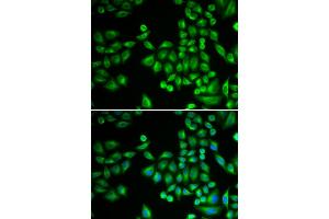 Immunofluorescence analysis of MCF-7 cells using PTPN1 antibody (ABIN5970769).