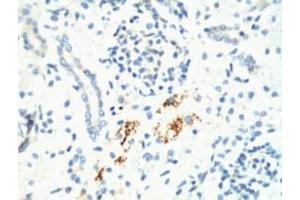IHC staining of Mouse Kidney tissue, diluted at 1:200. (KIF7 antibody)