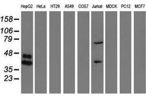 Western blot analysis of extracts (35 µg) from 9 different cell lines by using anti-HP monoclonal antibody. (Haptoglobin antibody)