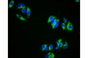 Immunofluorescence staining of HepG2 cells with ABIN7145704 at 1:333, counter-stained with DAPI. (BMPR1A antibody  (AA 177-532))