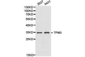 Western Blotting (WB) image for anti-Tropomyosin 3 (TPM3) antibody (ABIN1875182) (TPM3 antibody)