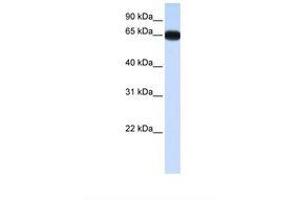 Image no. 1 for anti-Distal-Less Homeobox 4 (DLX4) (AA 38-87) antibody (ABIN6737752) (DLX4 antibody  (AA 38-87))