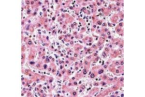 ALP antibody immunohistochemistry analysis in formalin fixed and paraffin embedded human liver tissue. (Alkaline Phosphatase antibody  (AA 282-309))